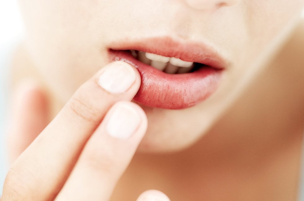 Recurring Cold Sores? #1 Reason You're Getting Frequent Cold Sores
